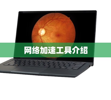 网络加速工具介绍